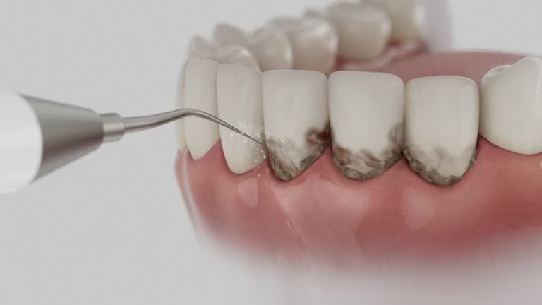 Trusted Teeth Cleaning And Checkup service in Phoenix, OR - Dentist Open Now